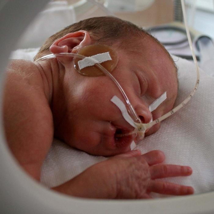 hipoksija u novorođenčadi