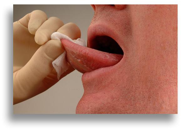Cosa fa gonfiare la lingua