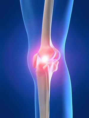 come trattare il dolore al ginocchio