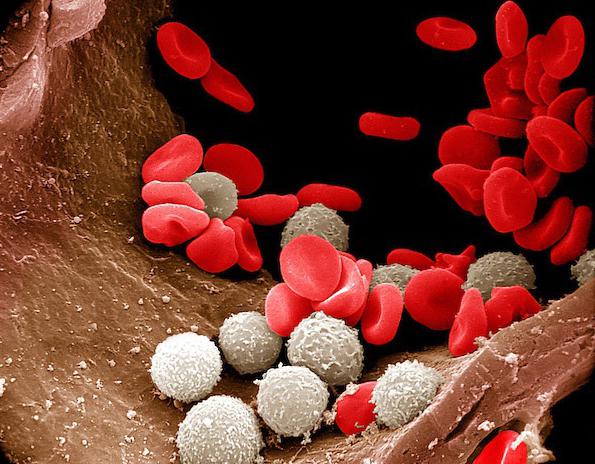 povećani uzroci leukocita u krvi