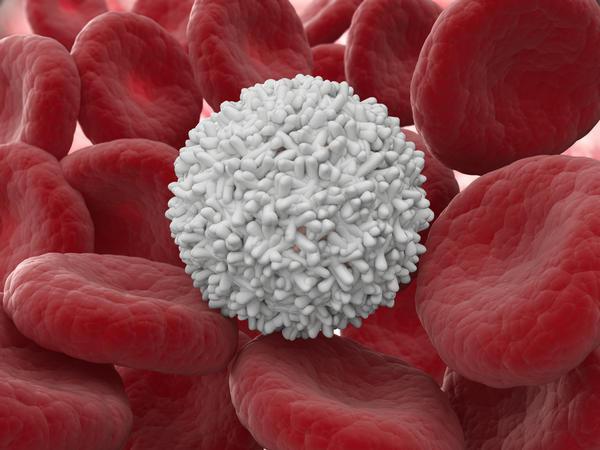 uzroci i liječenje visokog broja bijelih krvnih stanica