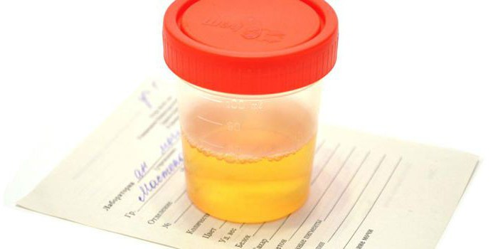 povečanje števila belih krvničk v urinu med nosečnostjo