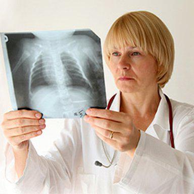 inkubační doba tuberkulózy plic