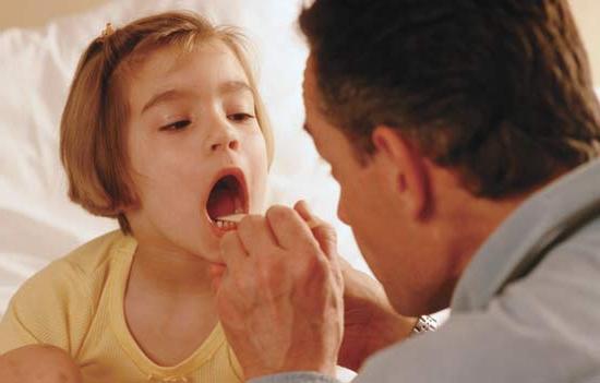 infiammazione delle tonsille