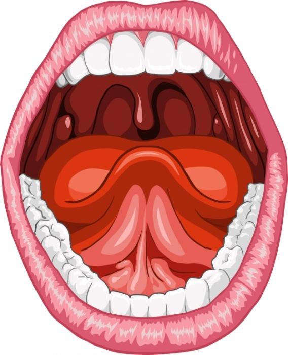 infiammazione dei sintomi delle tonsille