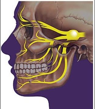 obličejový trigeminální nerv