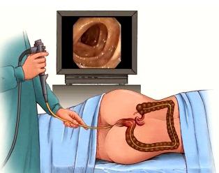 gastroenterologické vyšetření