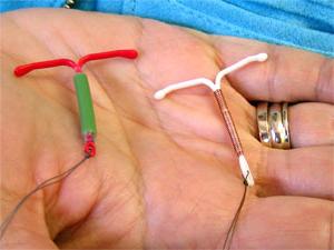 dispositivi intrauterini