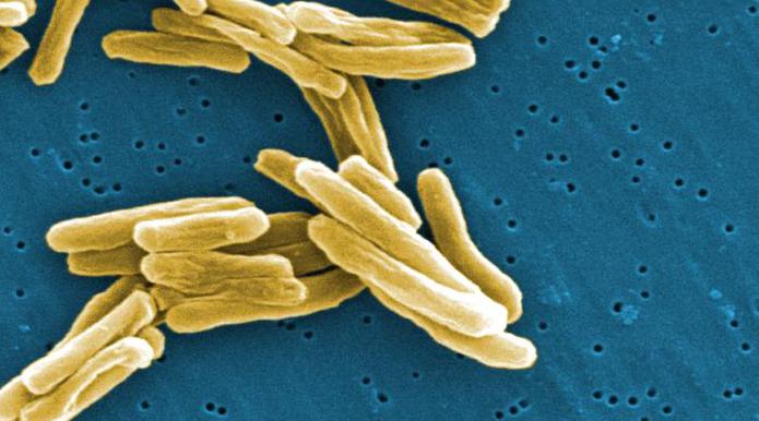 tuberkuloza je bolest