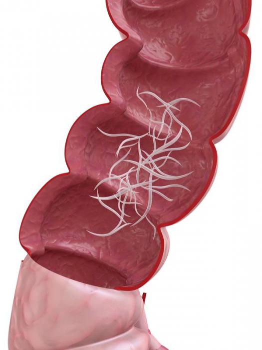 srbenje v anusu povzroča črve