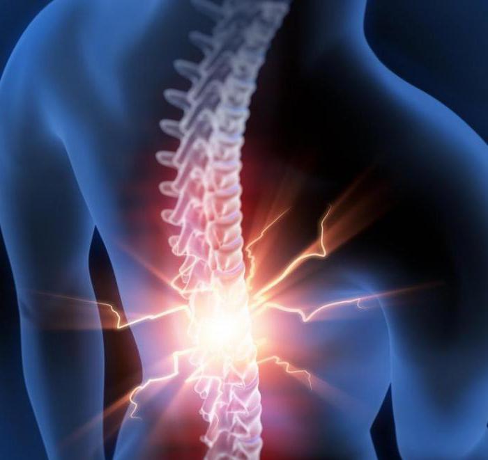 liječenje spinalne kile s pregledom elektroforeze karipazima