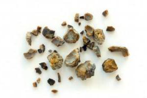симптоми на камъни в бъбреците при мъжете какво да правят