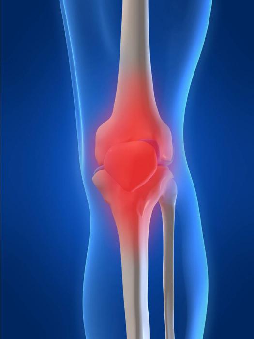 как да се премахне възпалението на колянната става