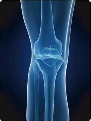 trattamento della malattia goff del ginocchio