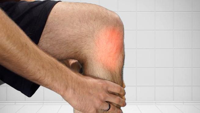 лигаментоза крижног лигамента зглоба колена