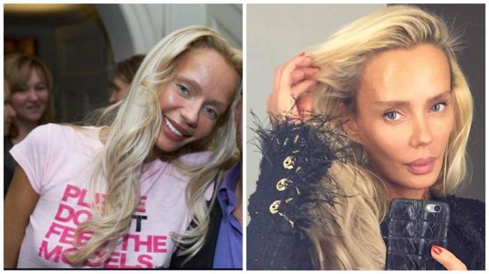 Kristina Sysojewa przed i po operacji plastycznej