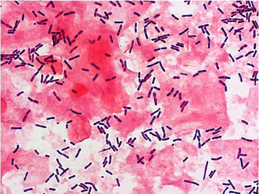 Normoflora lactobacillus spp