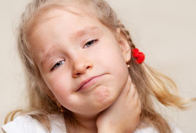 tonsillite lacunare in un bambino