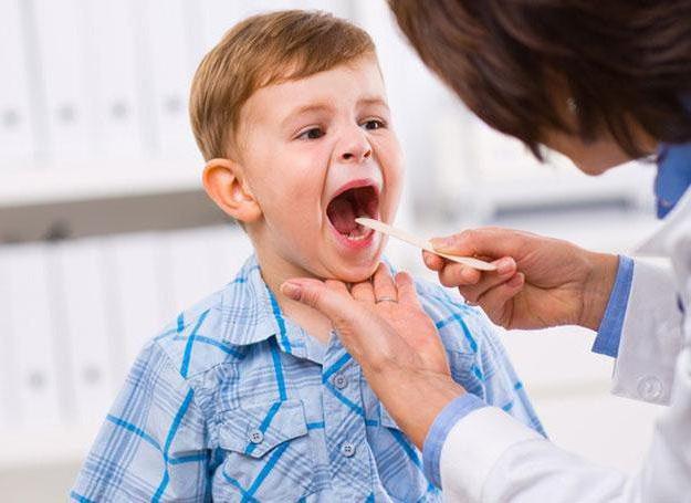 lakoniczne zapalenie migdałków u dzieci bez gorączki