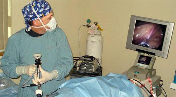 dieta przed laparoskopią w ginekologii