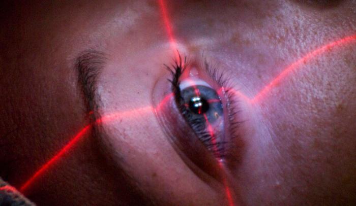 recensioni di correzione della visione laser