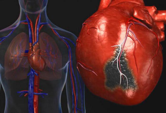 lijeve klijetke srčanog hipertenzije