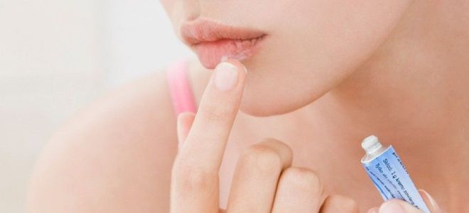 Lijek za lijepljenje u kutovima usana