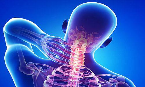 ból gardła w osteochondrozie kręgosłupa szyjnego