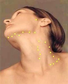 limfni čvorovi u vratu