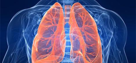 linfoadenopatia polmonare