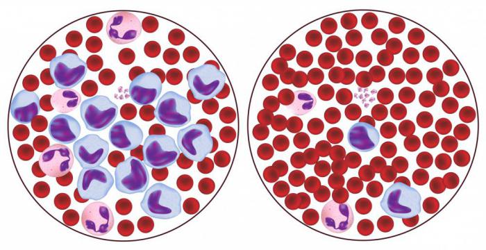 limfocyty we krwi są podwyższone