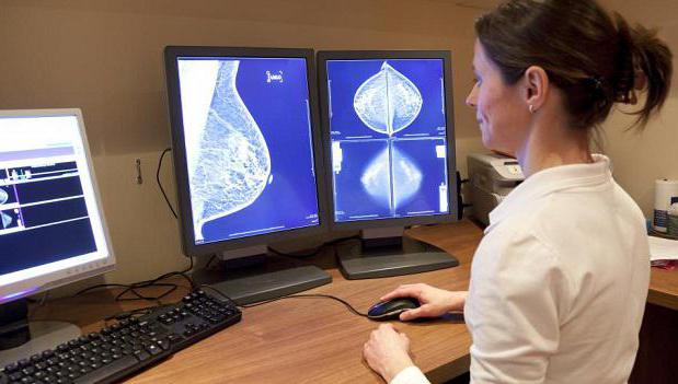 kde dělat mamografii
