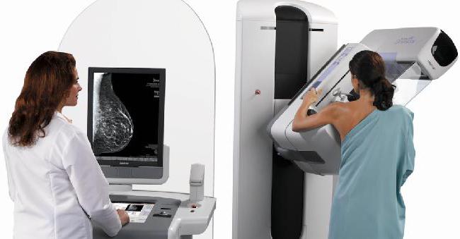 кога трябва да се направи мамография