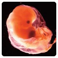 iniezioni di ossitocina per l'aborto