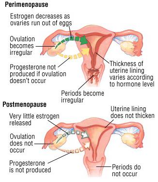 simptomi menopauze u žena
