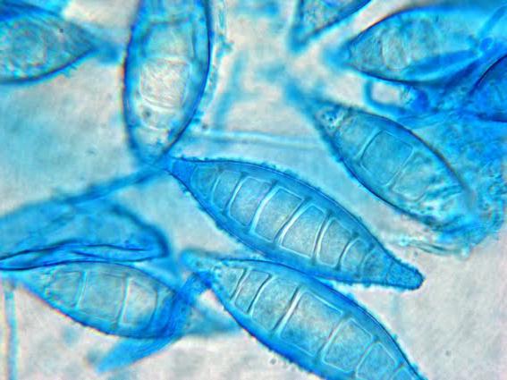 ludzka mikrosporia
