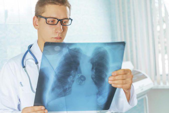 miliarna tuberkuloza