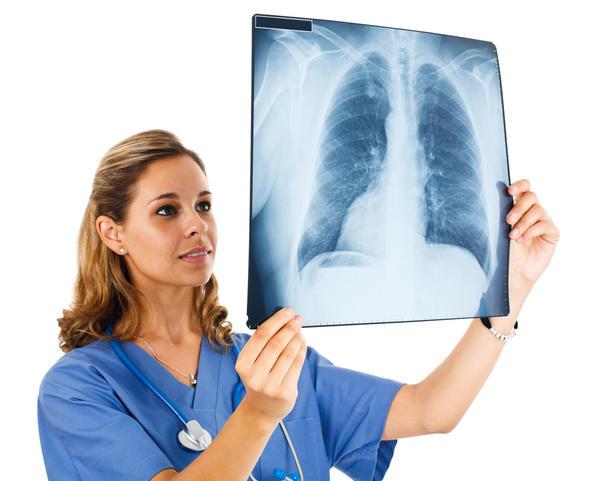 fase di trattamento del cancro del polmone 4