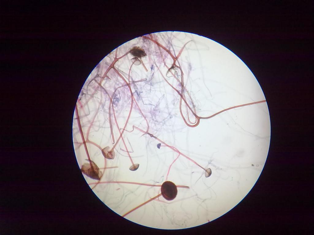 mukory hyfy pod mikroskopem