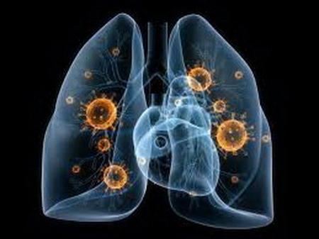 mykoplazma a chlamýdiová pneumonie