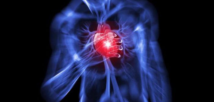 Akutní infarkt myokardu