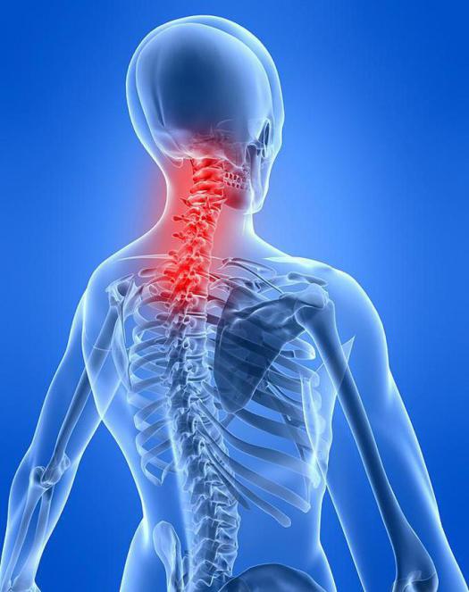 sintomi della miosite del collo