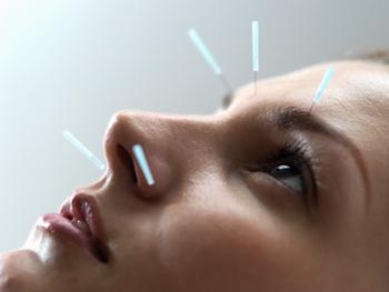 как да се лекува неврит на лицевия нерв