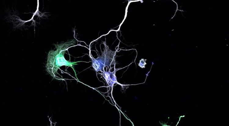 Komunikacija med nevroni