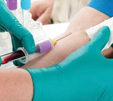 Test krvi  Tumačenje: kreatinin