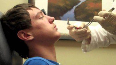 léčba zlomeniny nosu