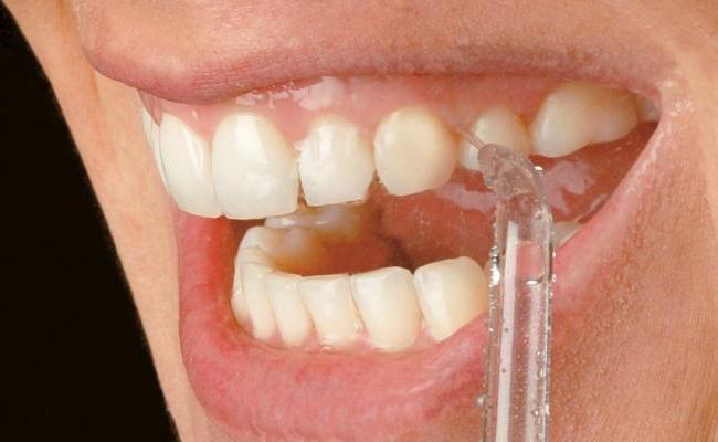 Come usare l'irrigatore per la cavità orale