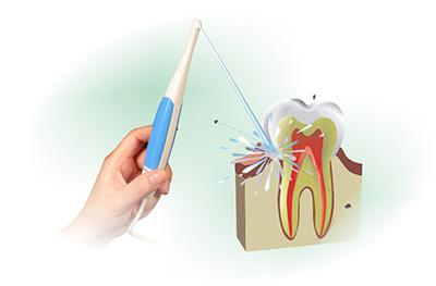 Prohlídky zavlažovače ústní dutiny