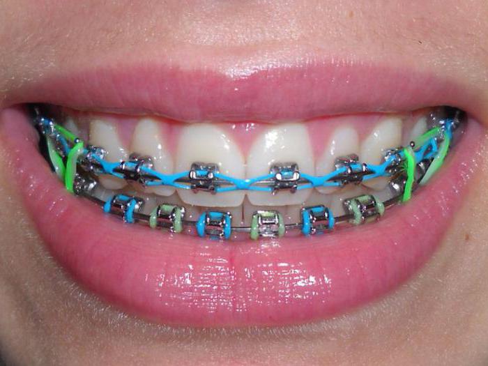 ustna b zobna zobna ščetka