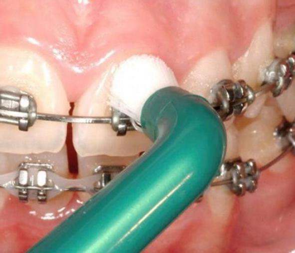 Zobna ščetka za zobne ščetke